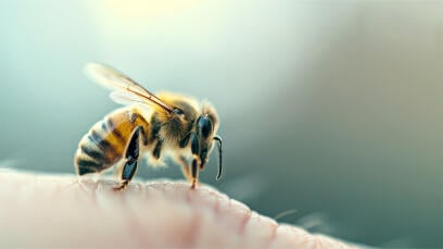 Was tun bei einem Bienenstich bzw. Wespenstich?