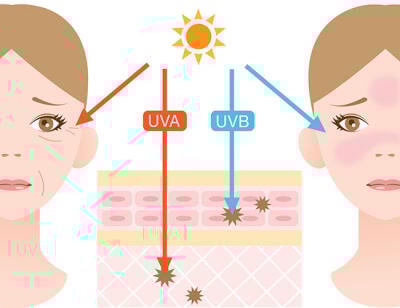 Sonnenallergie Ursachen: UV-A Licht Grafik